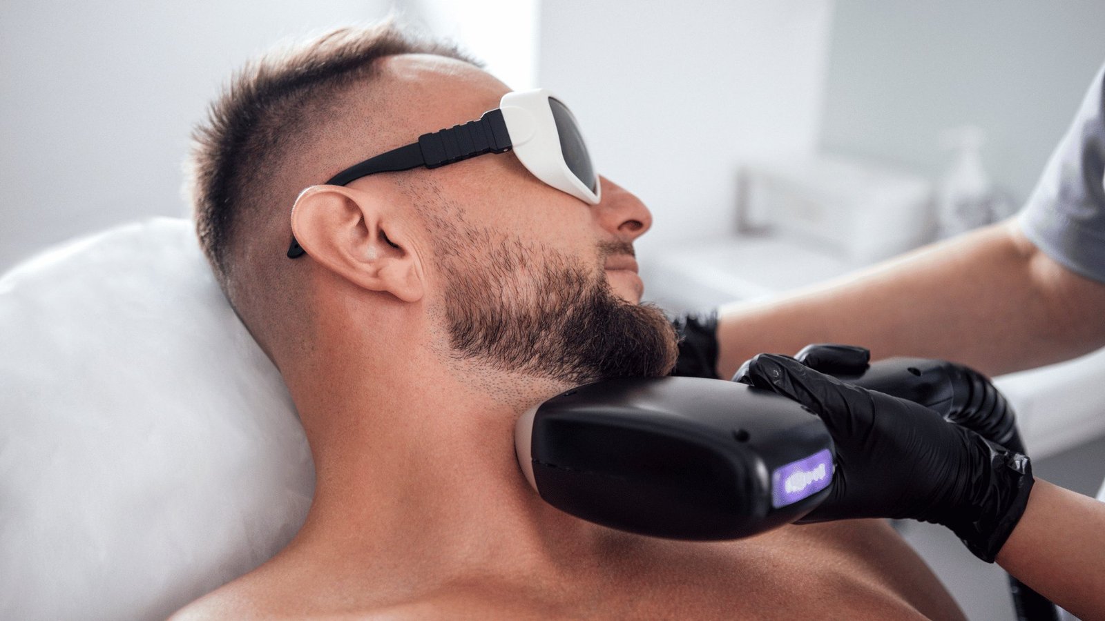 Depilación láser facial para hombre en Barcelona